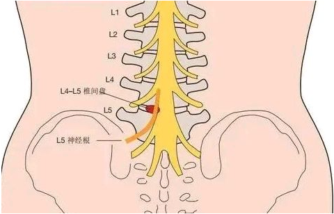 邵陽(yáng)創(chuàng  )傷骨科,邵陽(yáng)風(fēng)濕病區,邵陽(yáng)骨質(zhì)增生,邵陽(yáng)關(guān)節病區,邵陽(yáng)頸椎病區