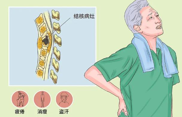 邵陽(yáng)創(chuàng  )傷骨科,邵陽(yáng)風(fēng)濕病區,邵陽(yáng)骨質(zhì)增生,邵陽(yáng)關(guān)節病區,邵陽(yáng)頸椎病區